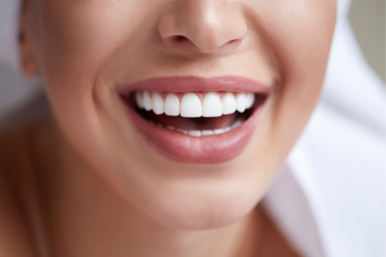 teeth whitening - dentisry