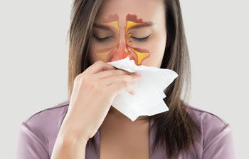 Management of nasal allergic condition- Shanta Medical Centre<br />
