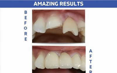 Get Your Perfect Smile!