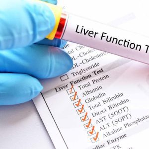 Liver Function Test - Mini